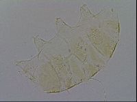 Echiniscus trisetosus image