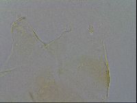 Echiniscus trisetosus image