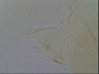 Echiniscus trisetosus image
