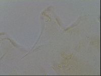 Echiniscus trisetosus image