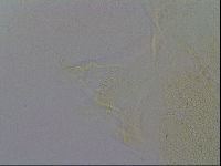 Echiniscus trisetosus image