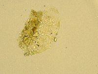 Echiniscus trisetosus image