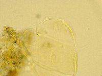 Echiniscus trisetosus image