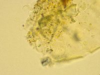 Echiniscus trisetosus image
