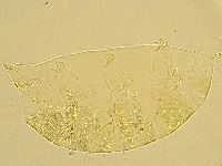 Echiniscus trisetosus image