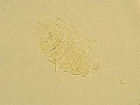 Echiniscus trisetosus image