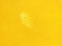 Echiniscus trisetosus image