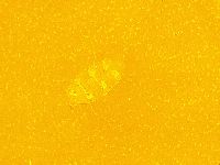 Echiniscus trisetosus image