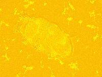 Echiniscus trisetosus image