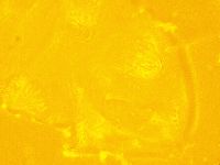 Echiniscus trisetosus image