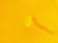 Echiniscus trisetosus image