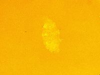 Echiniscus trisetosus image