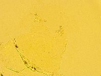 Echiniscus trisetosus image