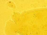 Echiniscus trisetosus image