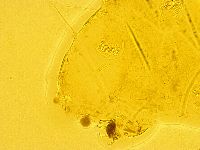 Echiniscus trisetosus image