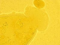 Echiniscus trisetosus image