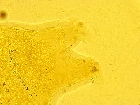 Echiniscus trisetosus image
