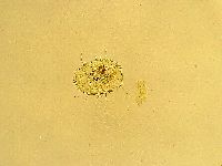 Echiniscus trisetosus image