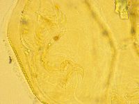 Echiniscus trisetosus image