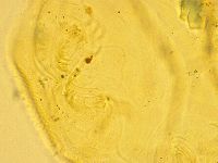 Echiniscus trisetosus image