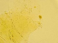 Echiniscus trisetosus image