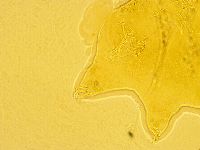 Echiniscus trisetosus image