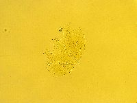 Echiniscus trisetosus image