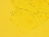 Echiniscus trisetosus image