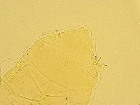 Echiniscus trisetosus image