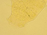 Echiniscus trisetosus image