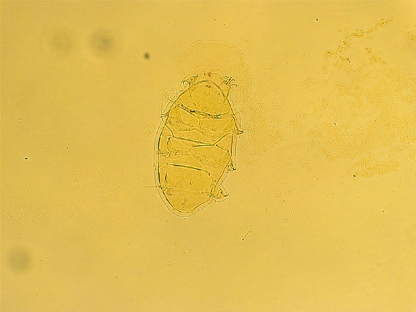 Echiniscus trisetosus image