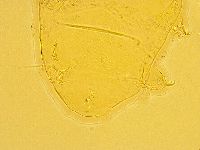Echiniscus trisetosus image