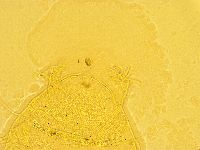 Echiniscus trisetosus image