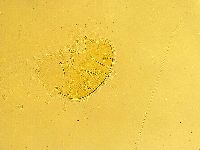 Echiniscus trisetosus image