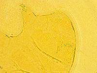 Echiniscus trisetosus image