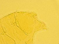Echiniscus trisetosus image