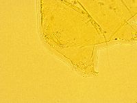 Echiniscus trisetosus image
