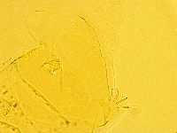Echiniscus trisetosus image
