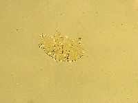 Echiniscus trisetosus image