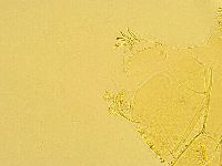 Echiniscus trisetosus image