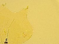 Echiniscus trisetosus image