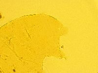 Echiniscus trisetosus image