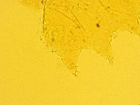 Echiniscus trisetosus image