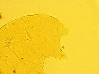 Echiniscus trisetosus image