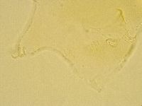 Echiniscus trisetosus image