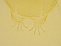 Echiniscus trisetosus image