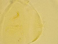 Echiniscus trisetosus image