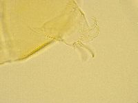Echiniscus trisetosus image