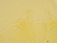 Echiniscus trisetosus image