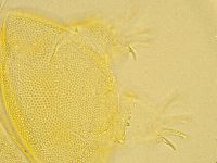 Echiniscus trisetosus image